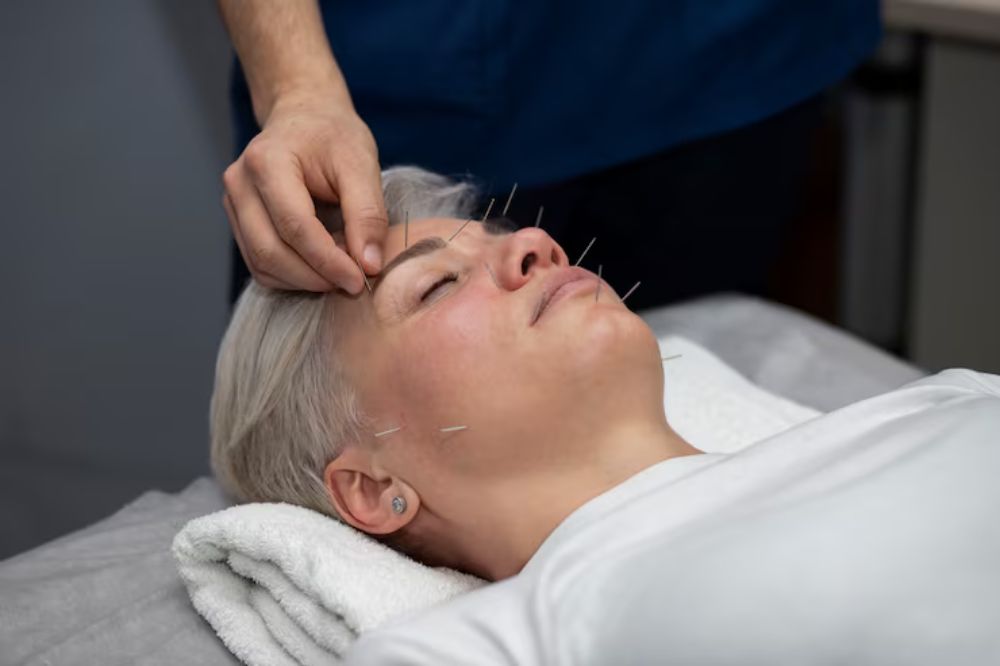 how often should you get acupuncture for best results