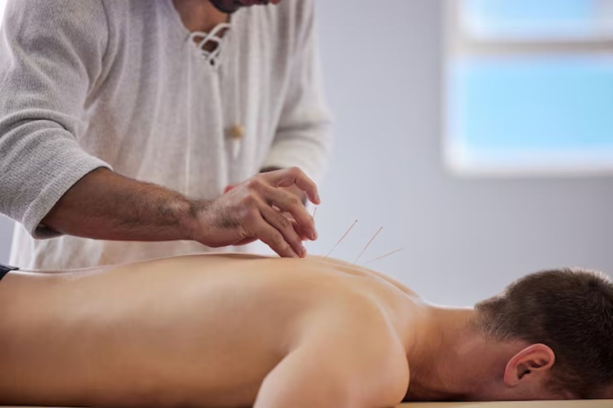 patient-receiving-acupuncture-therapy-to-support-calmness-and-overall-wellness